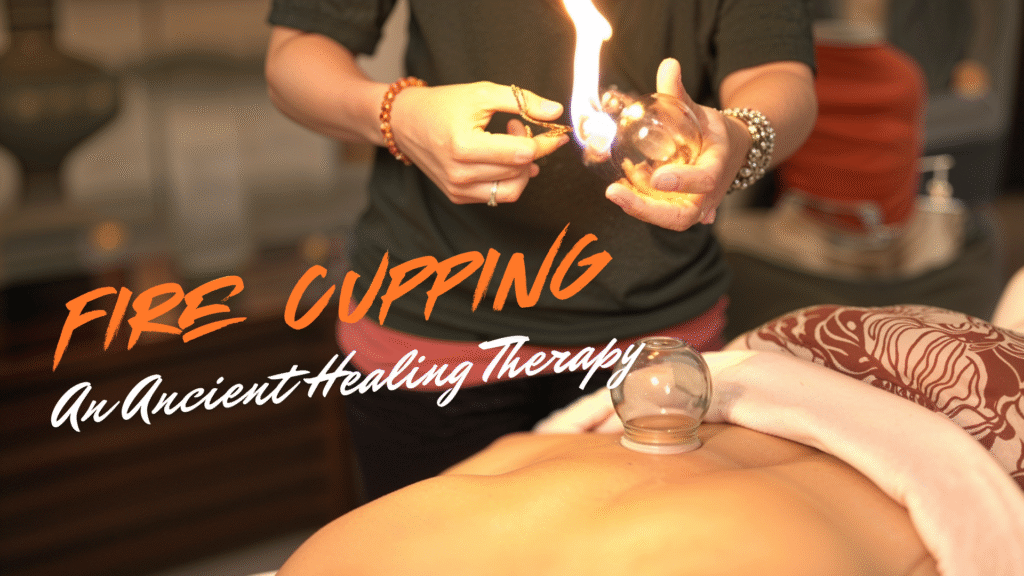 FIRE CUPPING