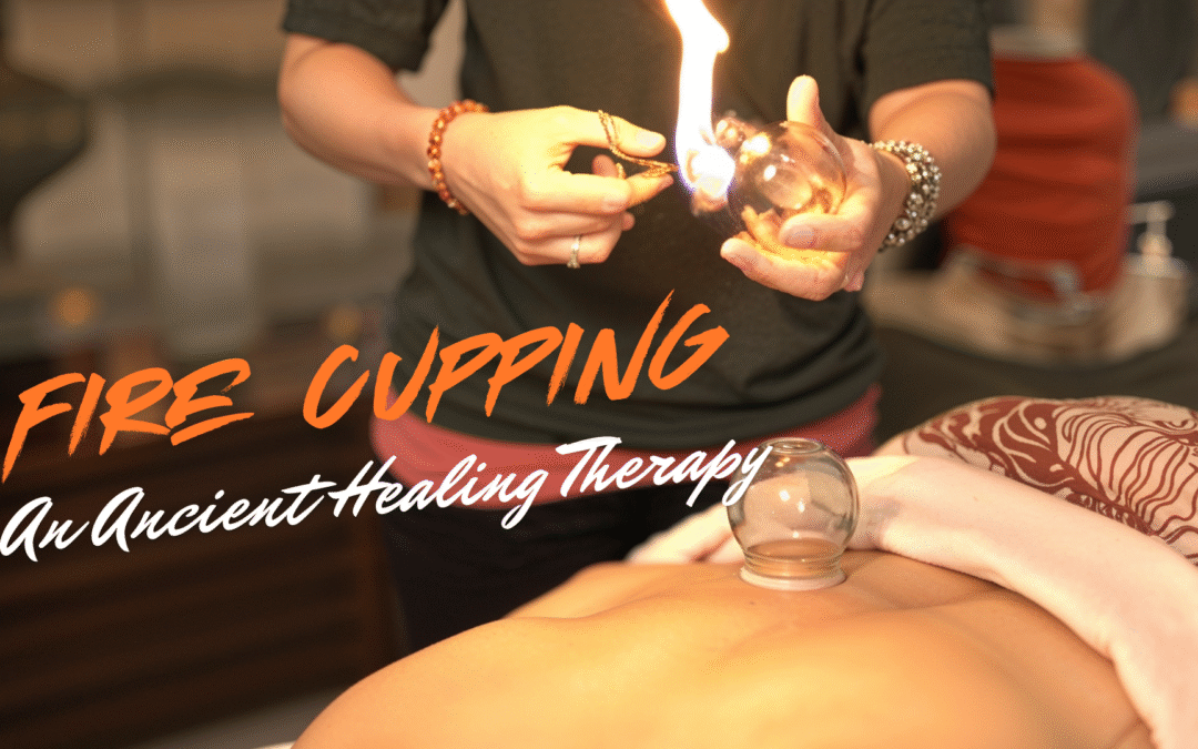 Fire Cupping: An Ancient Healing Therapy Explained