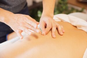 Acupuncture Healing in Buffalo Grove