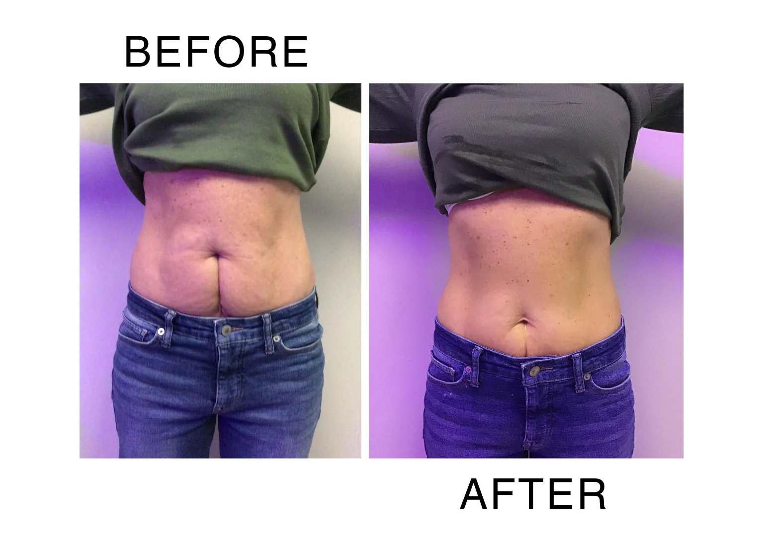 Before and After Cryo