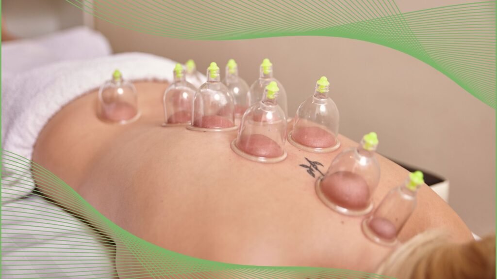 Cupping Therapy